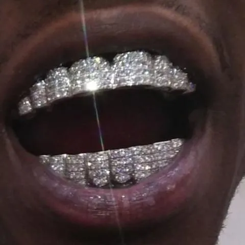 18K White Gold Iced Out Diamond Grillz Set